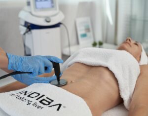 Lee más sobre el artículo Indiba: Qué es y cuáles son sus sorprendentes beneficios para tu cuerpo